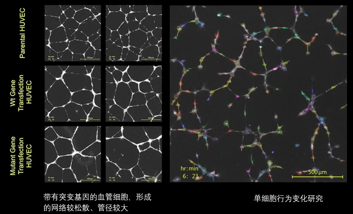 6、血管分析.png