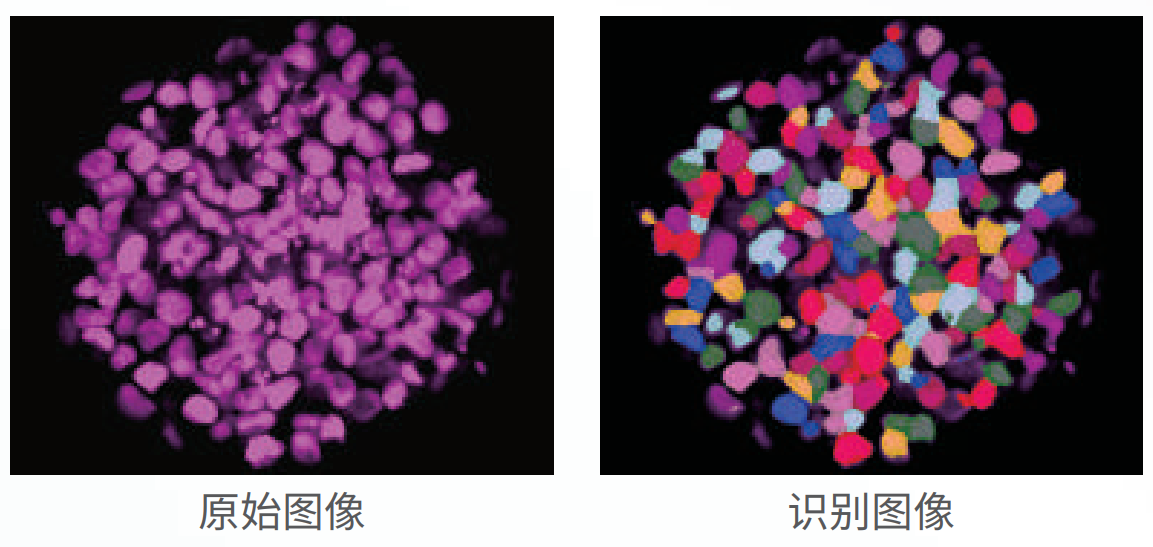 應(yīng)用3：類器官、球體成像.png